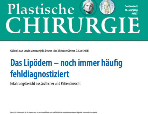 Das Lipödem – noch immer häufig fehldiagnostiziert